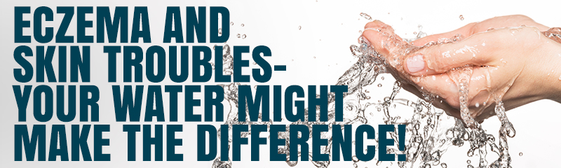 Eczema and skin troubles - Your water might make the difference blog header